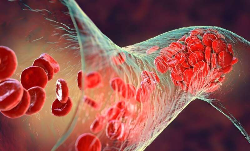 Rate of venous thromboembolism increased with cancer surgery
