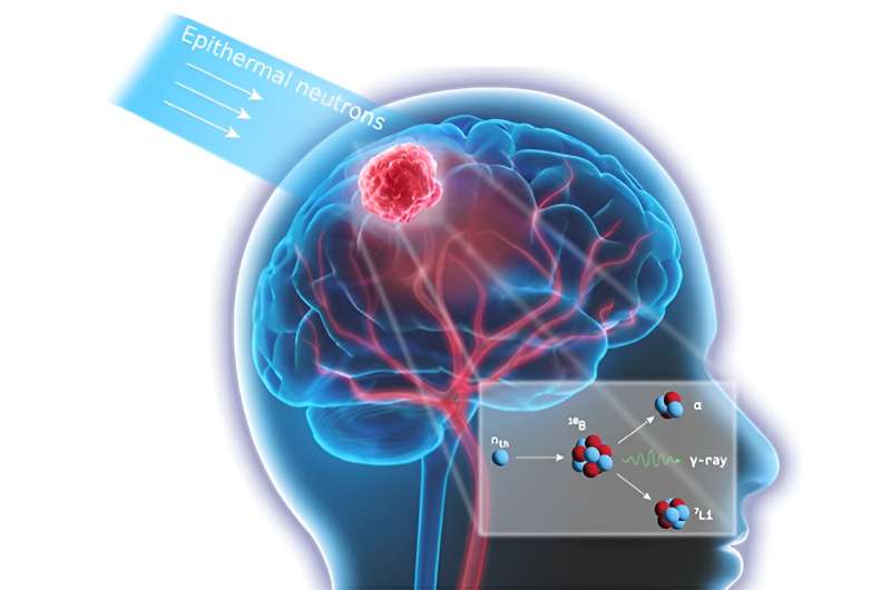 Real-time, cost-effective monitoring of neutron beams used in boron neutron capture therapy