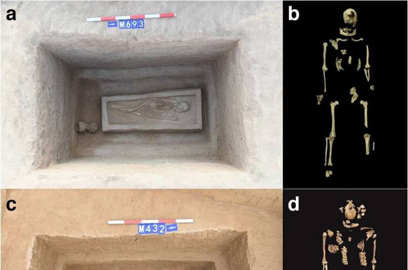 Remains of two men from central China shed light on ancient practice of punitive amputation