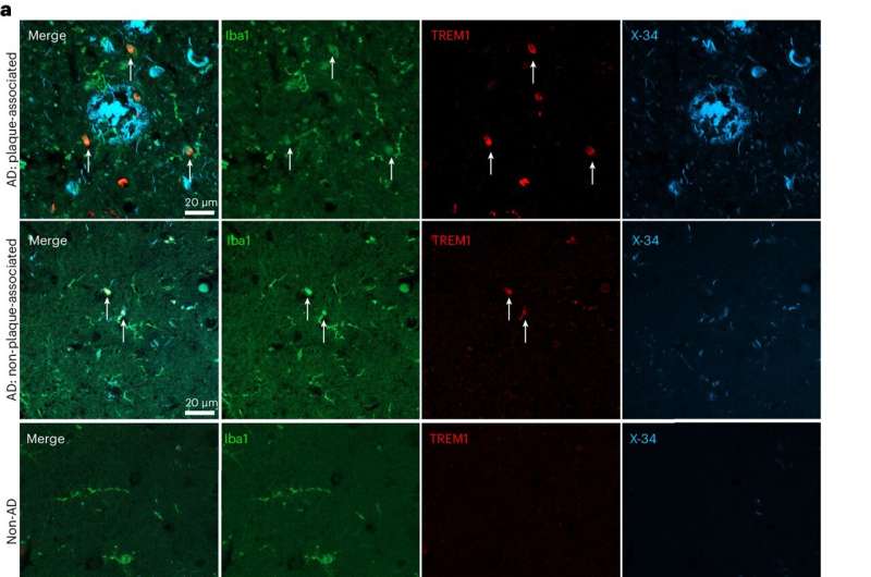 Research links age-related inflammation, microglia and Alzheimer’s disease