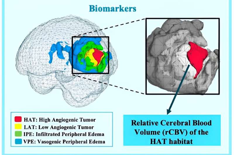 Research opens up a new approach for improving personalized treatment of patients with glioblastoma