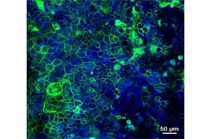 I ricercatori risolvono un mistero chiave sulla celiachia