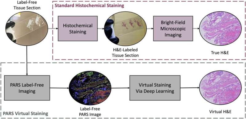 Researchers create an AI-powered digital imaging system to speed up cancer biopsy results