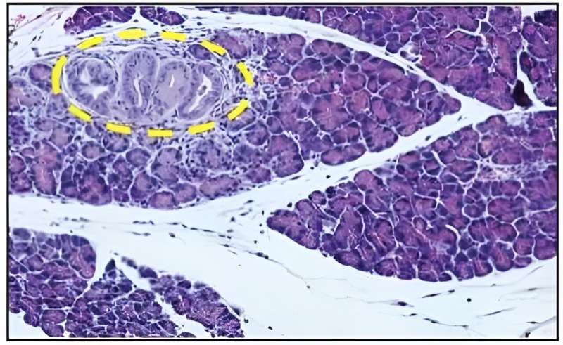 Researchers determine oral bacteria accelerate pancreatic cancer development in mice