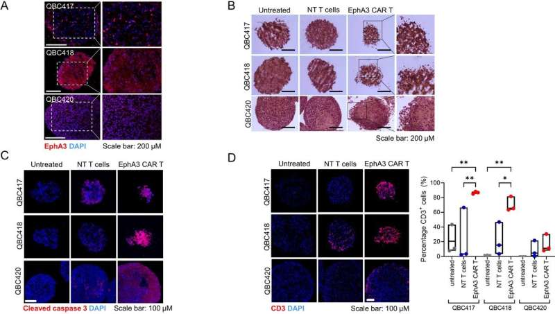 Researchers develop pioneering immunotherapy for aggressive brain cancer