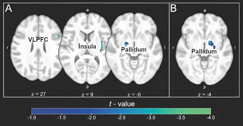 Researchers investigate neural response to imaginary placebo intake for regulating disgust