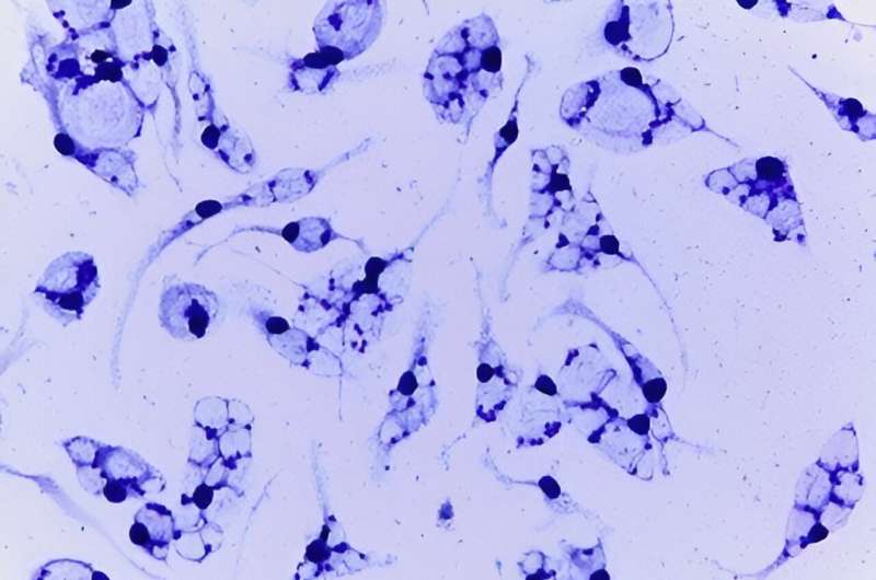 Resistance to the main drugs used in Brazil against Leishmania is found in parasite infecting cutaneous leishmaniasis patient