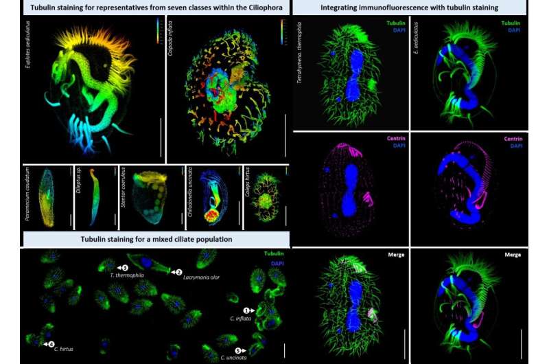 Revealing the beauty of ciliated eukaryotes: A simple and versatile method for tubulin staining with outstanding performance