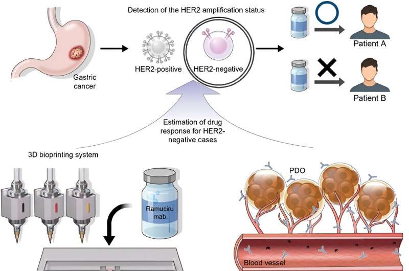 Revolutionizing gastric cancer treatment through personalized 3D bioprinting
