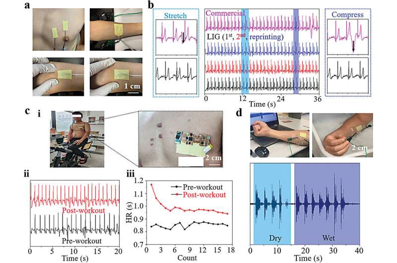 Rewritable, recyclable 'smart skin' monitors biological signals on demand