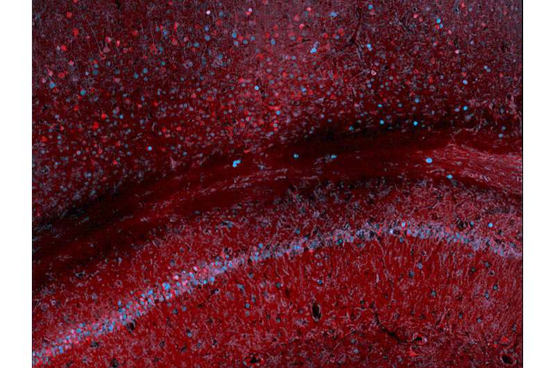 Rice scientists use blood test to track gene expression in the brain