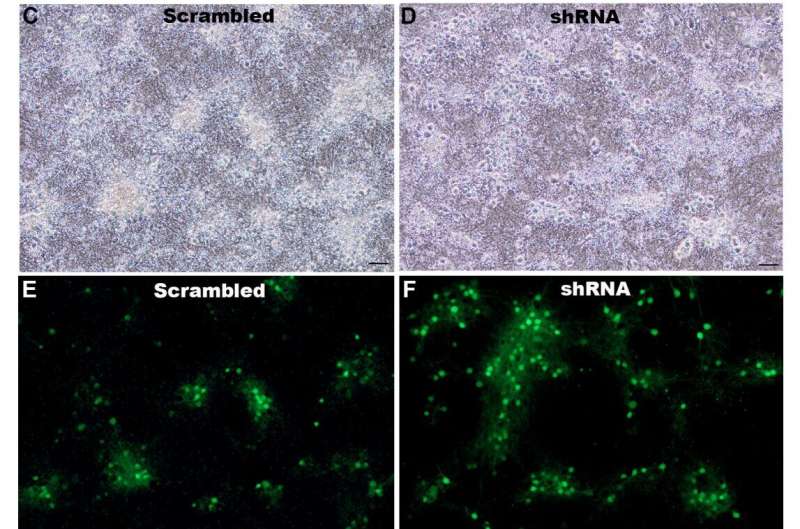 RNA treatment shows promise for enhancing memory and reducing anxiety