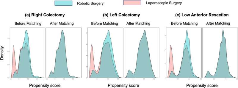Robotic surgery improves outcomes for most colon cancer patients