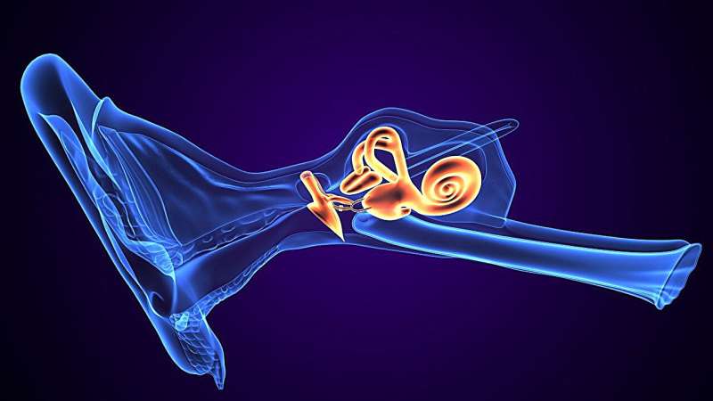 Saccule-to-utricle ratio inversion may ID early-stage meniere disease