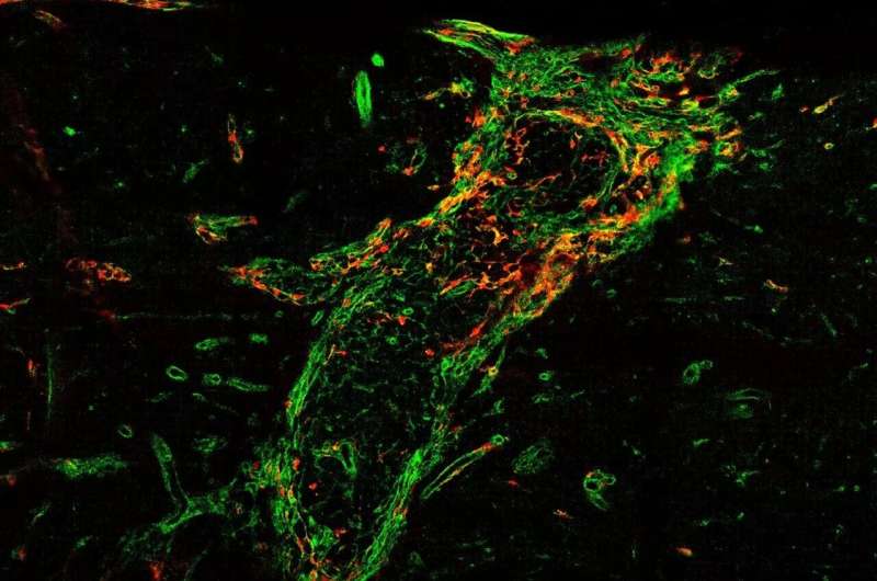 Scar formation after spinal cord injury is more complex than previously thought