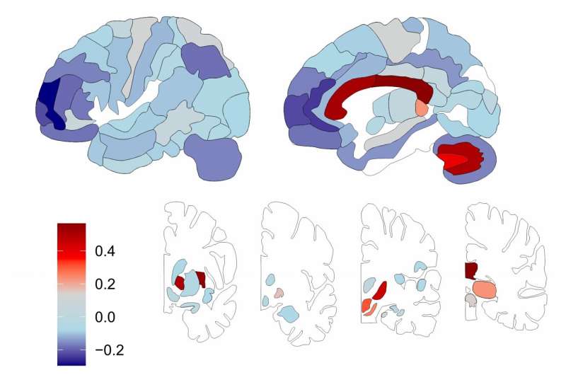 Scientists created a 'fatness map' of the human brain