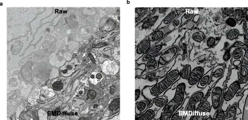 Scientists develop AI-driven method to enhance electron microscopy imaging capabilities of complex biological systems