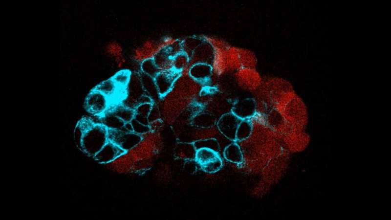 Scientists discover how the physics of colon cancer cells contributes to metastasis
