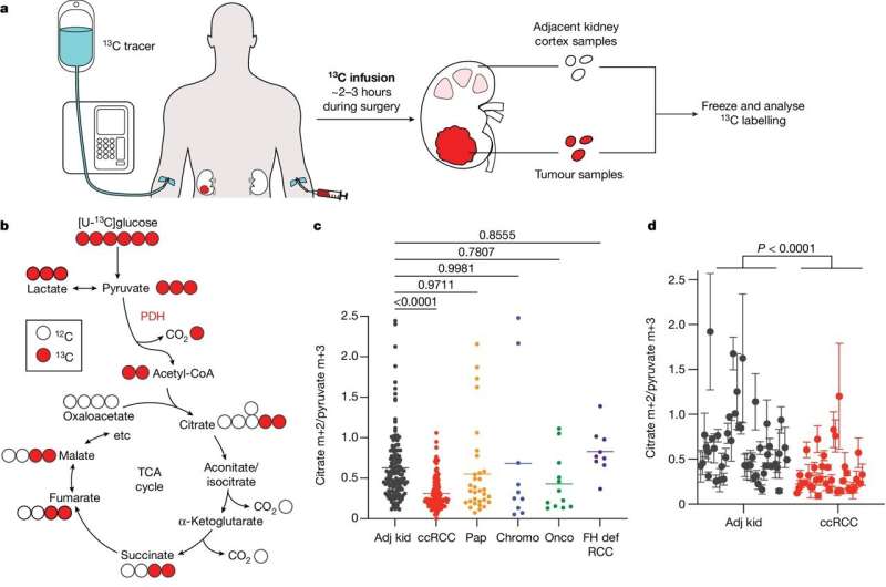 Scientists discover kidney cancers rely on mitochondrial metabolism to metastasize