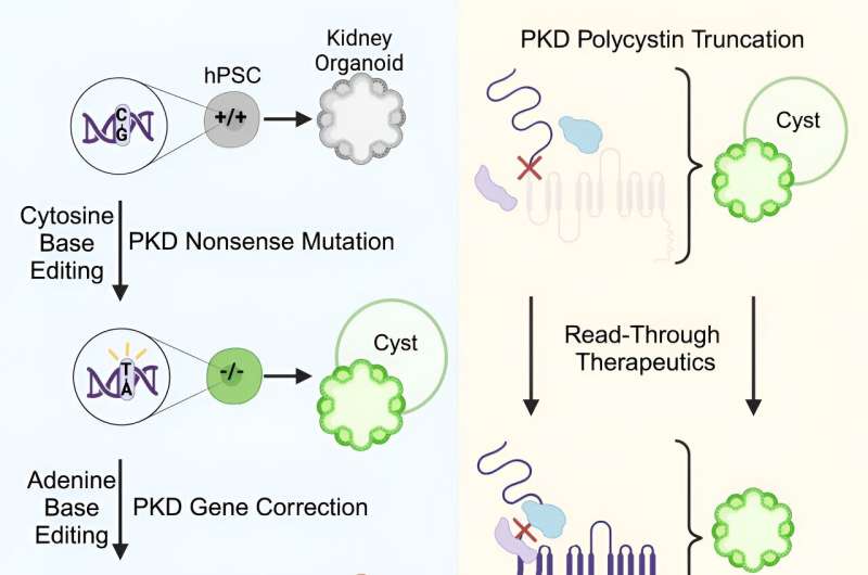 Scientists discover potential treatment approaches for polycystic kidney disease