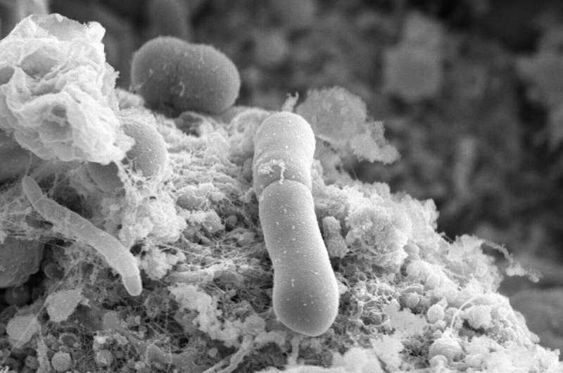 Scientists discover superbug's rapid path to antibiotic resistance