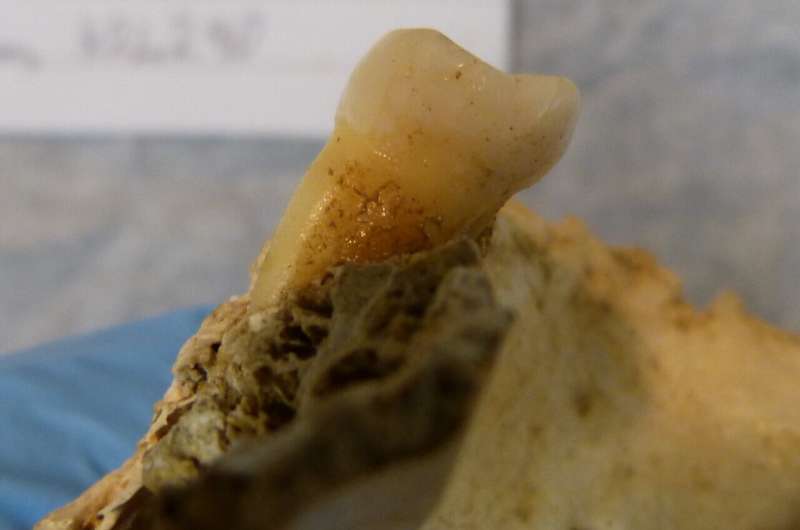 Scientists extract genetic secrets from 4,000-year-old teeth to illuminate the impact of changing human diets over the centuries