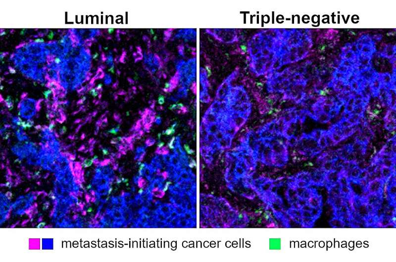 Scientists identify potential new immune system target to head off the spread of breast cancer cells