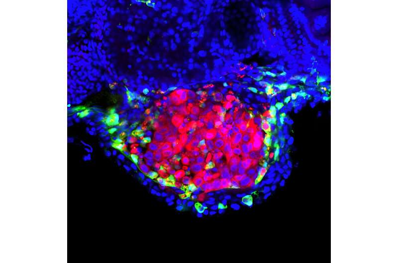 Scientists unravel how the BCG vaccine leads to the destruction of bladder cancer cells