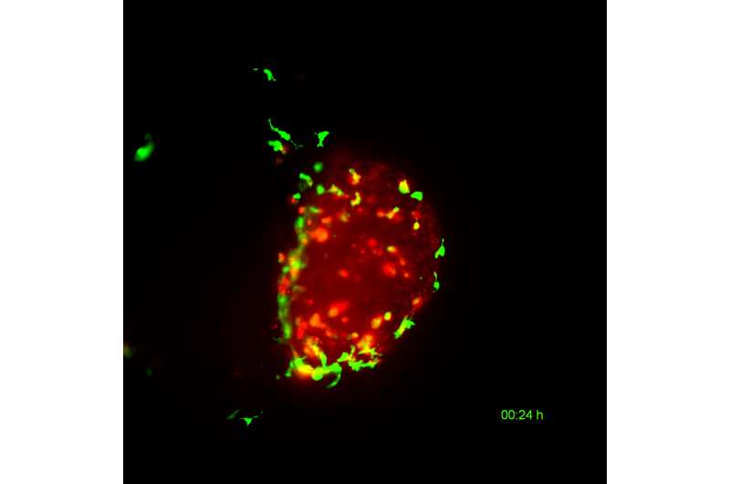 Scientists unravel how the BCG vaccine leads to the destruction of bladder cancer cells