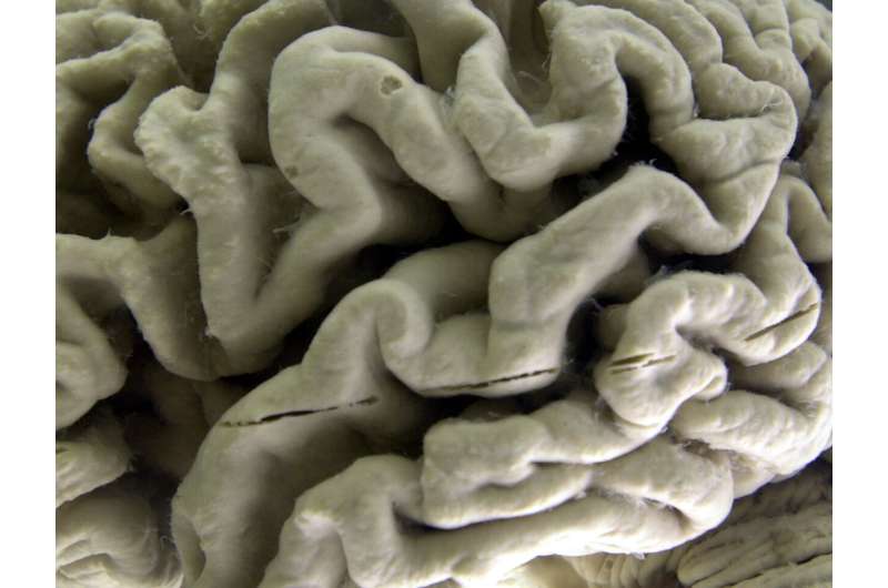 Silent brain changes precede Alzheimer's. Researchers have new clues about which come first