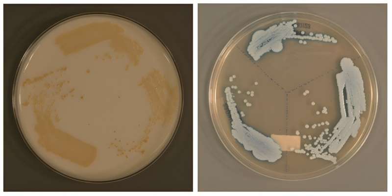 Singapore researchers discover new candida auris – a possible global public health threat