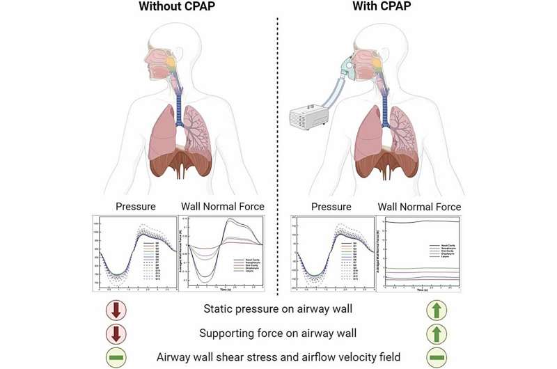 Sleep apnea patients can breathe easy about CPAP therapy, computer simulations suggest