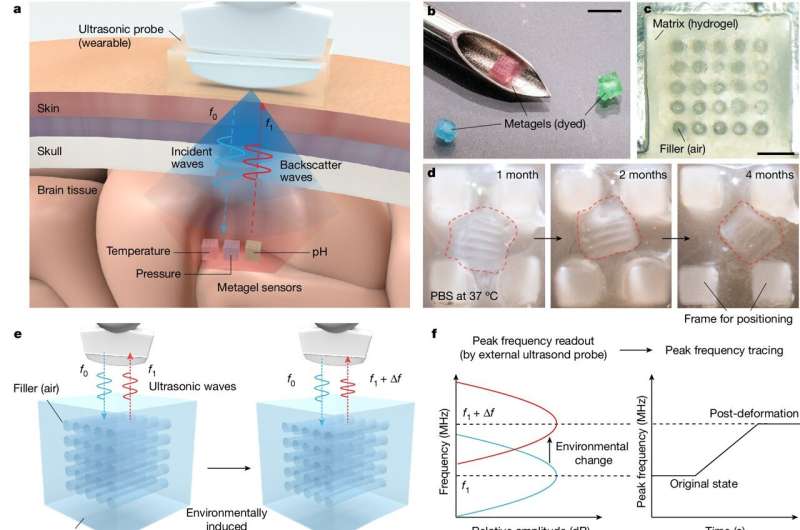 Smart hydrogel injected into intracranial fluid can be used to measure changes in temperature, pH or pressure