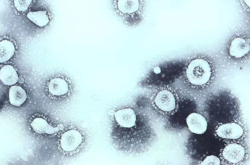 Some believe the 1889 Russian flu pandemic was actually caused by a coronavirus—here's why that's unlikely