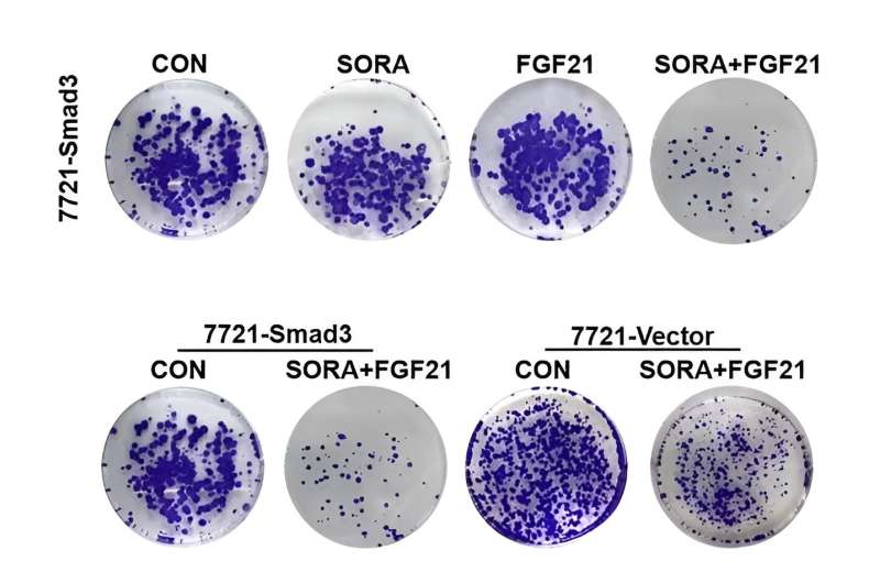 SORA combined with FGF21 can inhibit the growth and promote apoptosis of HCC cells through Smad3