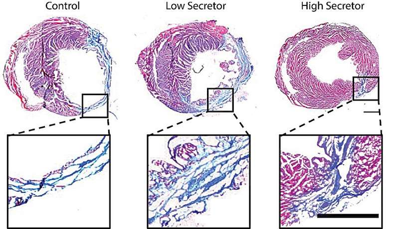 Sorting therapeutic stem cells by function improves healing after heart attack, lab study shows