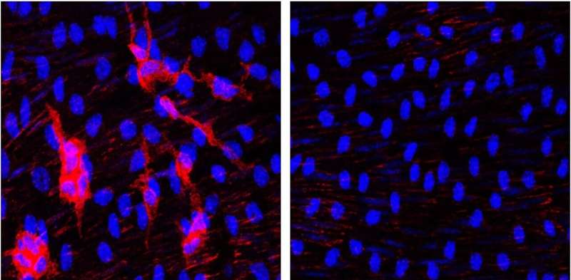 Spanish scientists identify the key cell type for strategies to prevent atherosclerosis in progeria syndrome