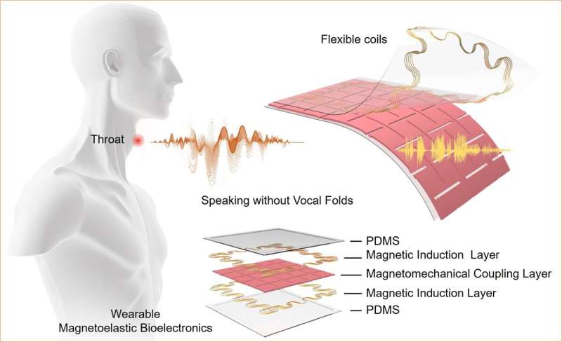 Speaking without vocal cords, thanks to a new AI-assisted wearable device