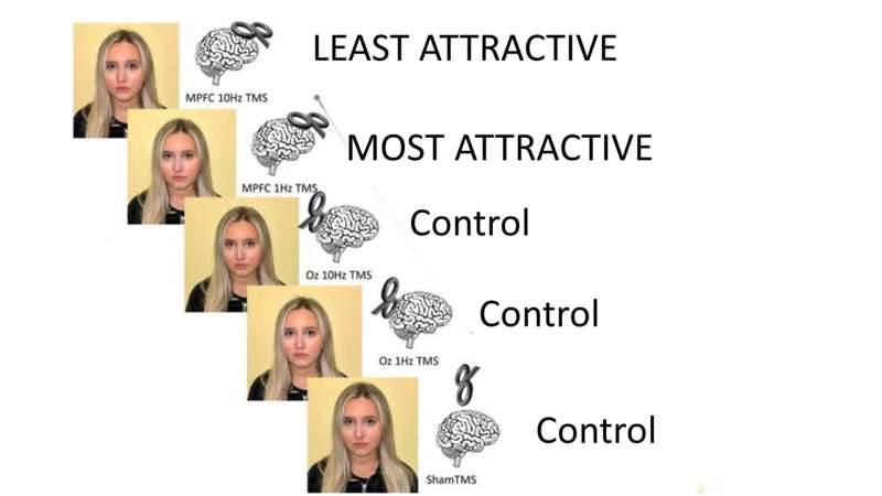 Stimulating the medial prefrontal cortex was found to change a person's perceived attractiveness