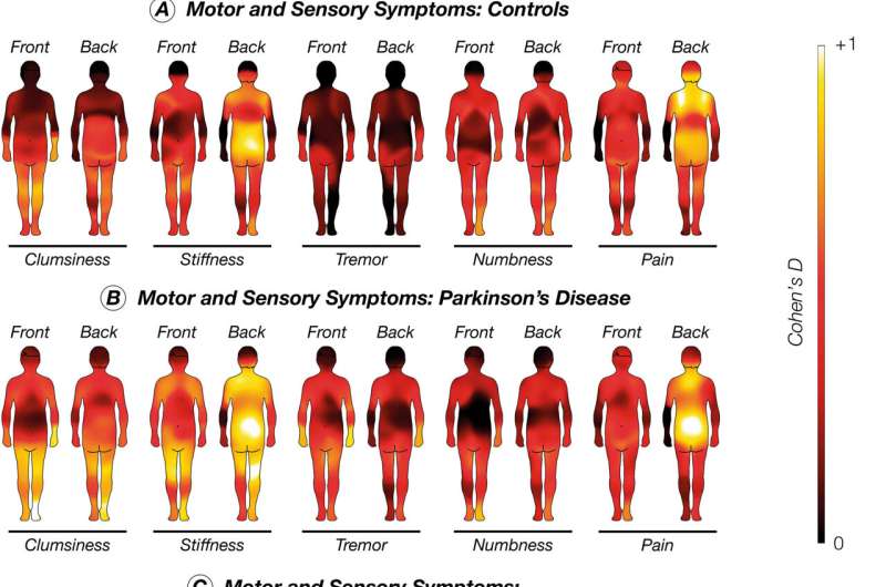 Stirring up emotions: Parkinson's disease alters emotion-related bodily sensations