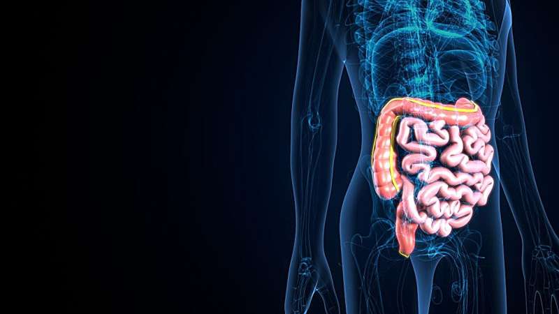 Study compares surgical techniques for crohn disease