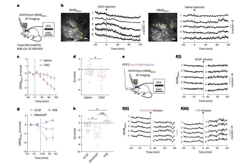 Study finds that microglia could regulate sleep via the modulation of norepinephrine transmission