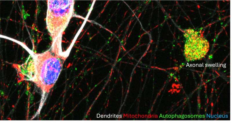 Study finds that the transport of mRNAs into axons along with lysosomal vesicles prevents axon degeneration