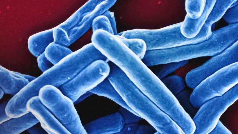 Study highlights factors associated with higher tuberculosis risk in South Africa