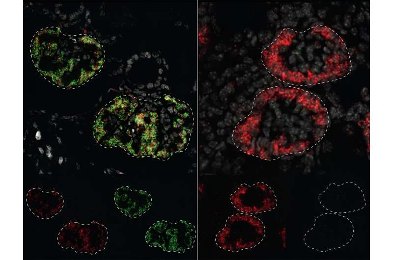 Study maps how genes instruct kidneys to develop differently in mice and humans