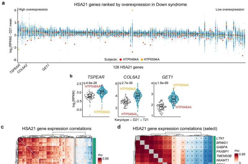 Study reveals molecular subtypes of Down syndrome, offering insights for personalized medicine approaches