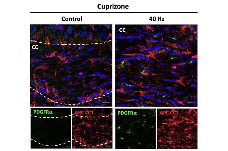 Study reveals ways in which 40Hz sensory stimulation may preserve brain's 'white matter'