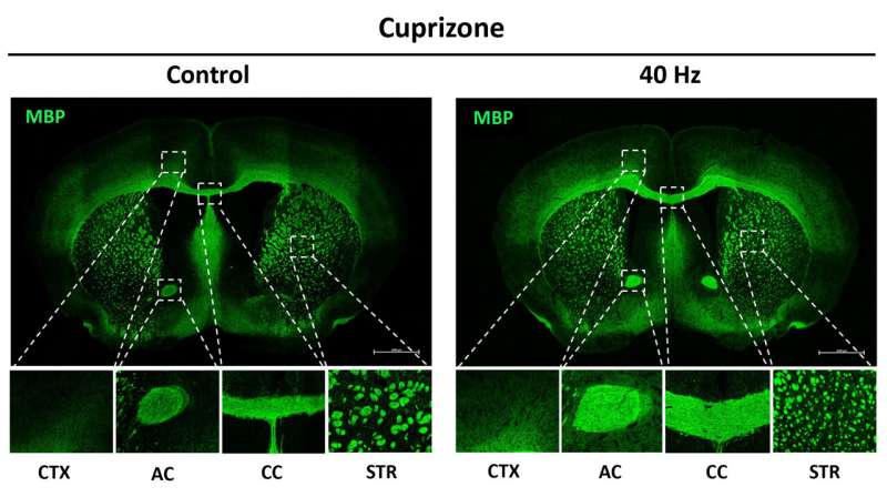 Study reveals ways in which 40Hz sensory stimulation may preserve brain's 'white matter'