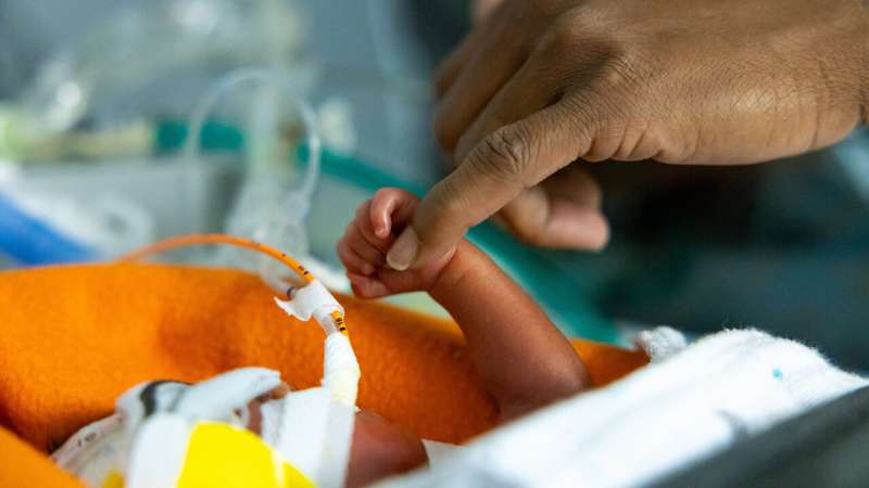 Study shows value of donated breast milk for extremely premature infants