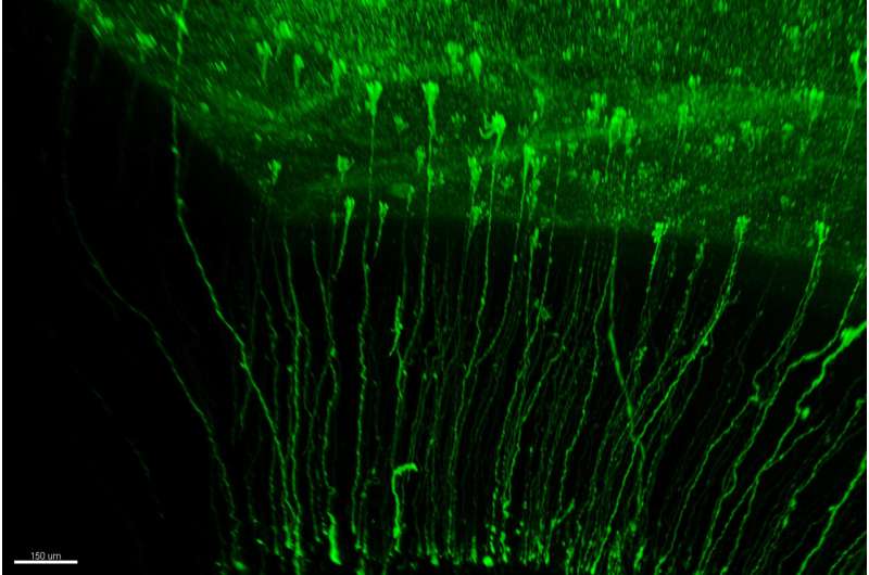 Study uncovers multiple lineages of stem cells contributing to neuron production